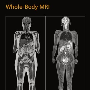 Full Body MRI In Less Than 10 Minutes Oakland MRI   Whole Body Mri 300x300 